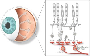 retinal-ganglion-cell